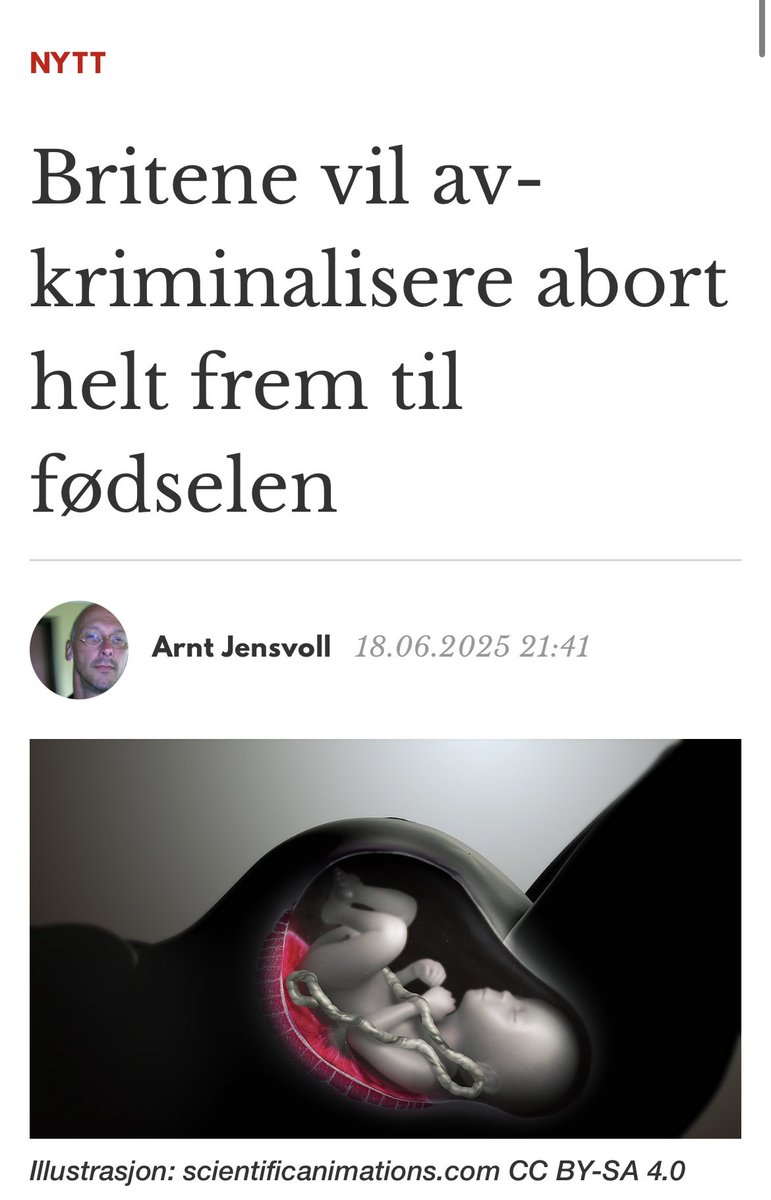 Hvis du forsvarer retten til å drepe et fullbårent barn, er du psykopat. Punktum.