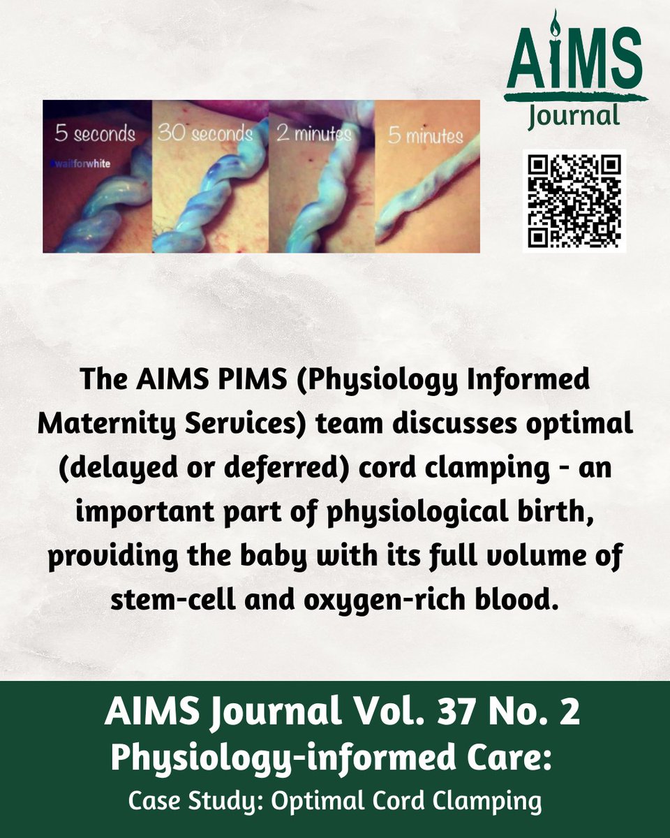 Case study: Optimal Cord Clamping. AIMS reminds us of the vital importance of leaving the cord intact for some minutes after almost any birth.
aims.org.uk/journal/item/o…
#optimalcordclamping #waitforwhite #bloodtobaby #delayedcordclamping