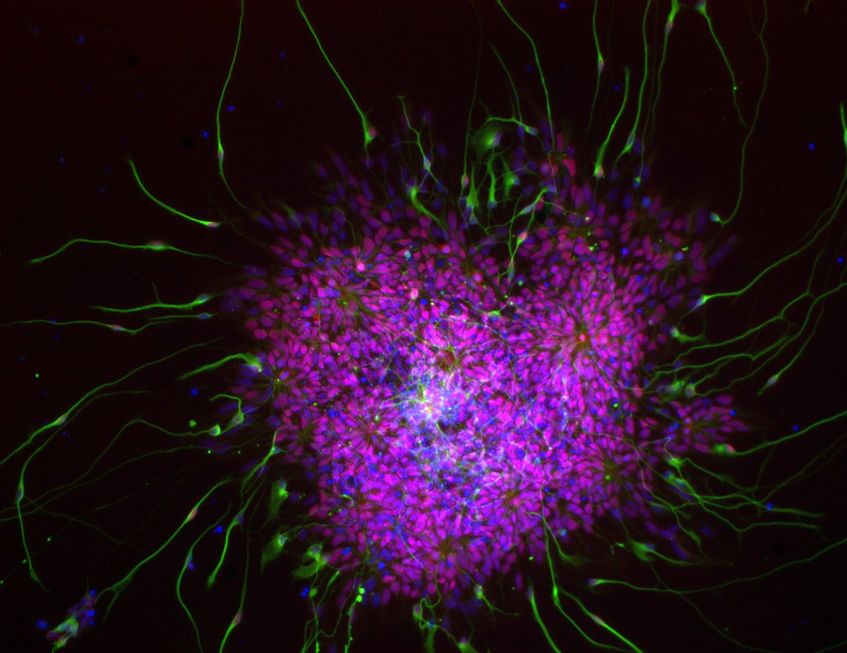 ARUKThamesV's tweet image. Congratulations to our ECR Image Award winners from our @AlzResearchUK Research Day!
Parnez Sharifi - Functional Landscapes: Dopamine Neurons at the Interface of Bioelectronics @AnneGliaFan - The Heart of Neurogenesis and @CharlieInTheLab - Team Spirit in Technicolour