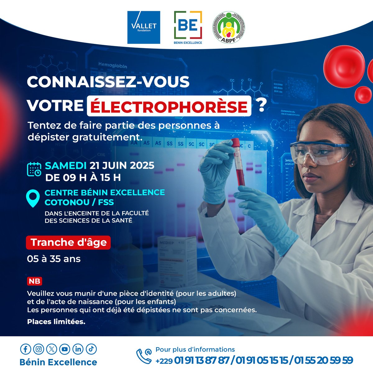 Participez à la campagne de dépistage gratuit de la drépanocytose ! 🥳
Pourquoi ? Pour votre bien-être et celui de vos proches.
C'est un geste simple pour une vie plus saine !
👩‍❤️‍👨👩‍❤️‍💋‍👨🩸💉🧬🔬
#drépanocytose #électrophorèse #ODD3 #bonnesanté #famille❤️ #bienêtre