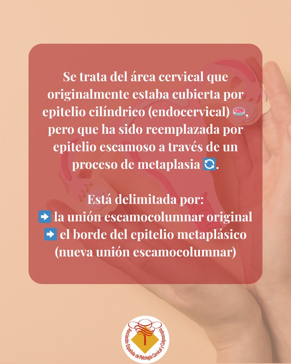 ❓Zona de transformación… ¿sabes qué es?

Es una parte clave de tu salud ginecológica.

👇En este post te lo explicamos

#ZonaDeTransformación #CuelloUterino #SaludFemenina #PrevenciónVPH #EducaciónGinecológica #VPH #DetecciónTemprana #AEPCC #Ginecología