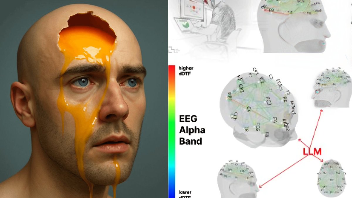 JensHonack's tweet image. WARNING:

MIT just discovered what ChatGPT is doing to your brain.

After scanning 54 people for 4 months, scientists found evidence of AI dulling your memory, focus, and decision-making.

Here&apos;s the real cost of using AI:🧵
(&amp;amp; how you should act immediately)