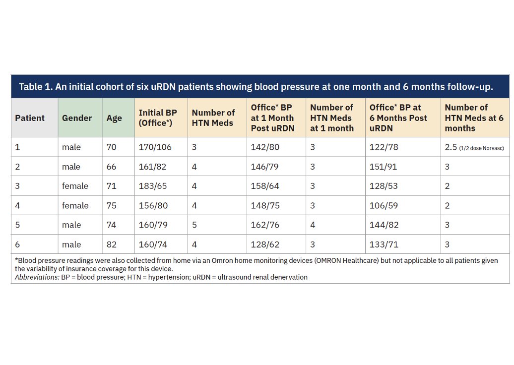 CathLabDigest's tweet image. Real-World Experience With the Paradise™ Ultrasound Renal Denervation System
Dr. Orestis Pappas, of Erie, Pa., shares his clinical experience using the Paradise™ Ultrasound Renal Denervation (uRDN) System (Recor Medical).
hubs.ly/Q03sjRhc0 #cardiotwitter @RecorMedical