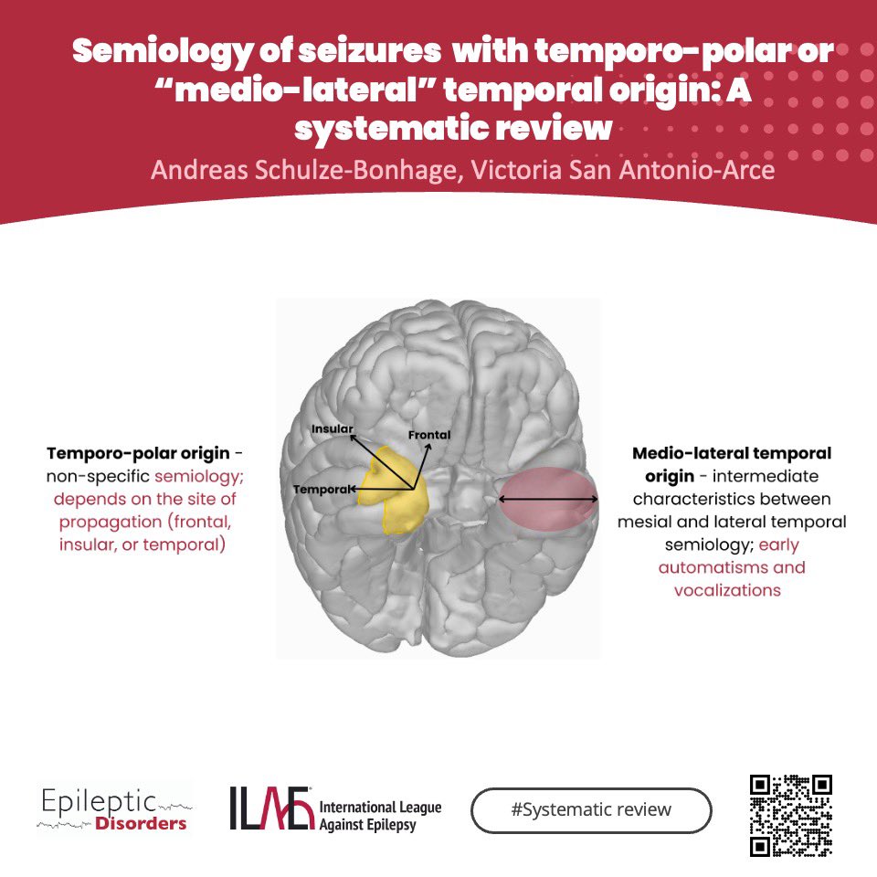 EpiDisorders's tweet image. What is semiology of temporal seizures? Check out the recent systematic review to discover!
🔗doi.org/10.1002/epd2.2…
@giocastellucci @SheikhISMD @joanajribeiro @SBeniczky @AnphyLab