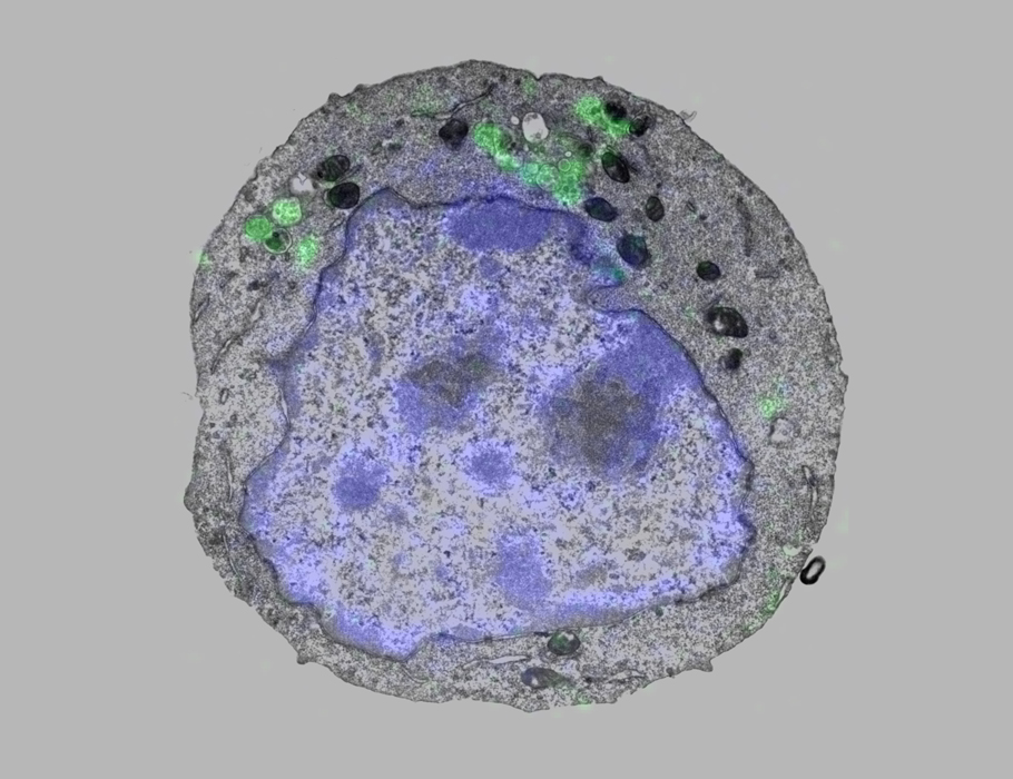 Science Signaling (@scisignal) on Twitter photo Although chemokines are known for their role in cell migration, new work in mice shows that CXCL12 also promotes the differentiation of #erythroblasts by promoting CXCR4 signaling and activity in the nucleus. <a href="/stevenduke/">Johan Duchene</a> <a href="/GutjahrJulia/">Julia Christine Gutjahr</a> <a href="/QMULWHRI/">William Harvey Research Institute</a> scim.ag/446wONU Although chemokines are known for their role in cell migration, new work in mice shows that CXCL12 also promotes the differentiation of #erythroblasts by promoting CXCR4 signaling and activity in the nucleus. <a href="/stevenduke/">Johan Duchene</a> <a href="/GutjahrJulia/">Julia Christine Gutjahr</a> <a href="/QMULWHRI/">William Harvey Research Institute</a> scim.ag/446wONU