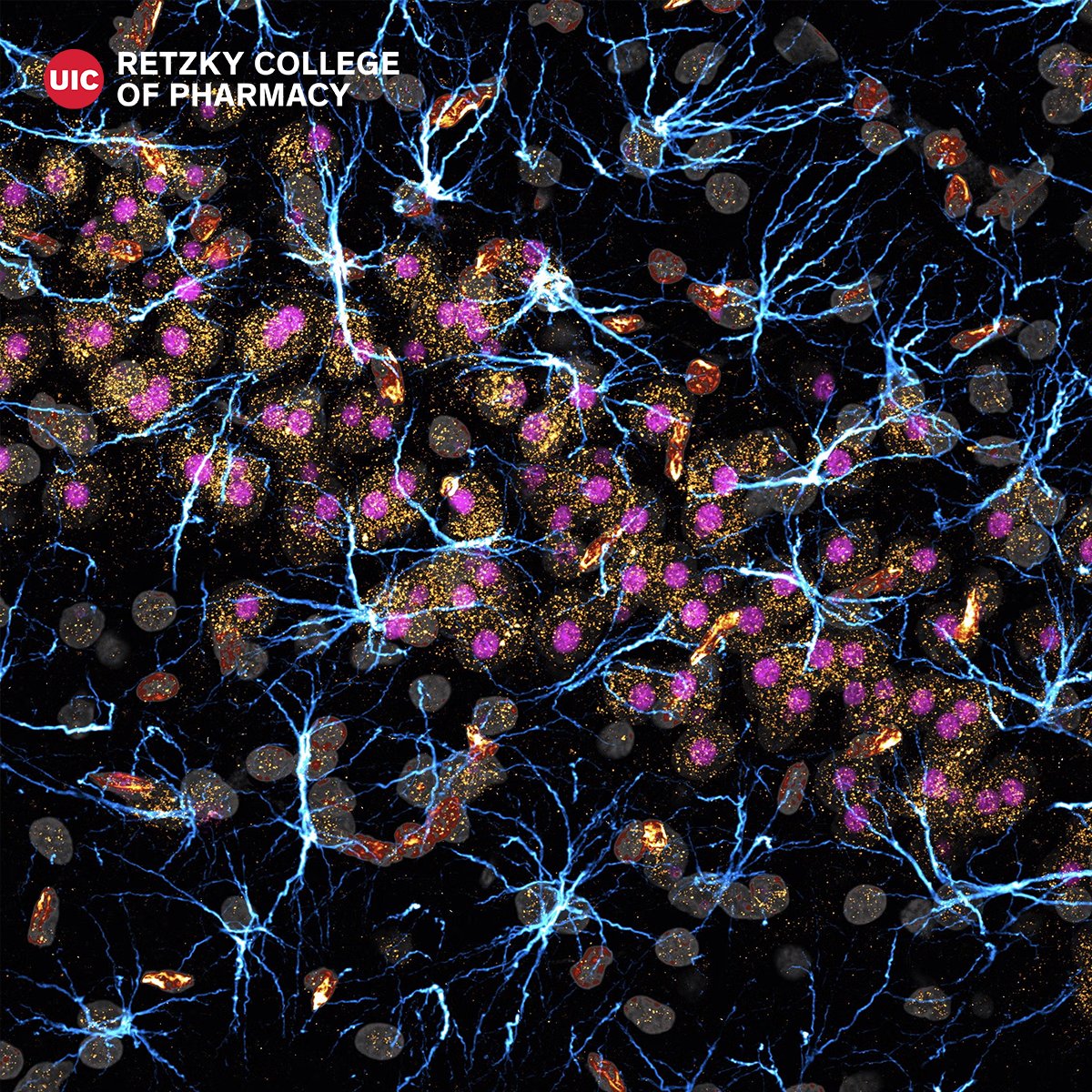 UIC Retzky College of Pharmacy (@uicpharm) on Twitter photo Jamuna Tandukar from the Gao Lab was featured in UIC Today. Jamuna's photo, “We’re Stardust, Remember?” won third place in the UIC Images of Research Competition. You can read the story here:  ow.ly/vjor50WbW6Q Jamuna Tandukar from the Gao Lab was featured in UIC Today. Jamuna's photo, “We’re Stardust, Remember?” won third place in the UIC Images of Research Competition. You can read the story here:  ow.ly/vjor50WbW6Q