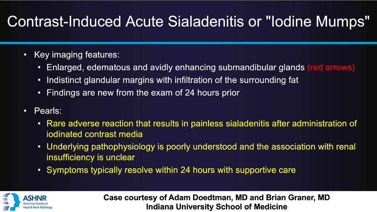 ASHNRSociety's tweet image. #ASHNRCOTW #302: ANSWER. Drs. Doedtman + Graner 4 case! #ASHNR25
@callyrobs @DShatzkes @CDP_Rad @rhwiggins
@nakoontz @KRileyMD @CMGlastonbury @tabby_kennedy @PhilipRChapman1 @cmtomblinson
@amyfjuliano @bpoliceni @MohitTCCNeuro @AshokSrini15 @KatieTraylorDO @CynXinWu