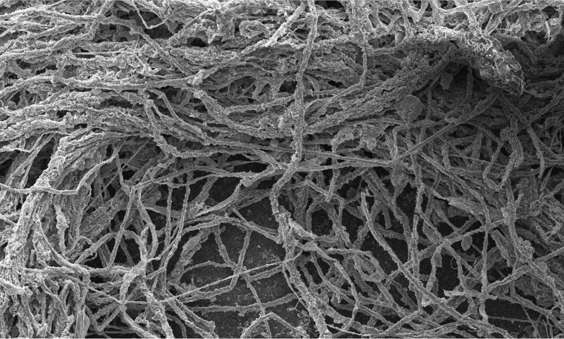 OSUElectroB's tweet image. Come hear my talk today (9:15–9:30 AM, LACC 403B) on our newly discovered cable bacteria species with sheath formation and ultra-wide ridges! #ASM2025 #ASMicrobes #cablebacteria