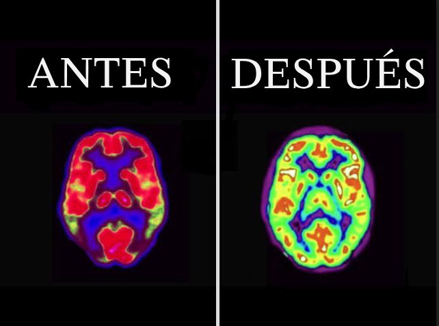 DOPAMINA:

La molécula que controla tu vida

Es la razón por la que ves p0rno, te cuesta concentrarte y vives pegado al móvil.

Aquí te explico (con ciencia real) qué es, cómo hackea tu cerebro y cómo salvarte de ella: