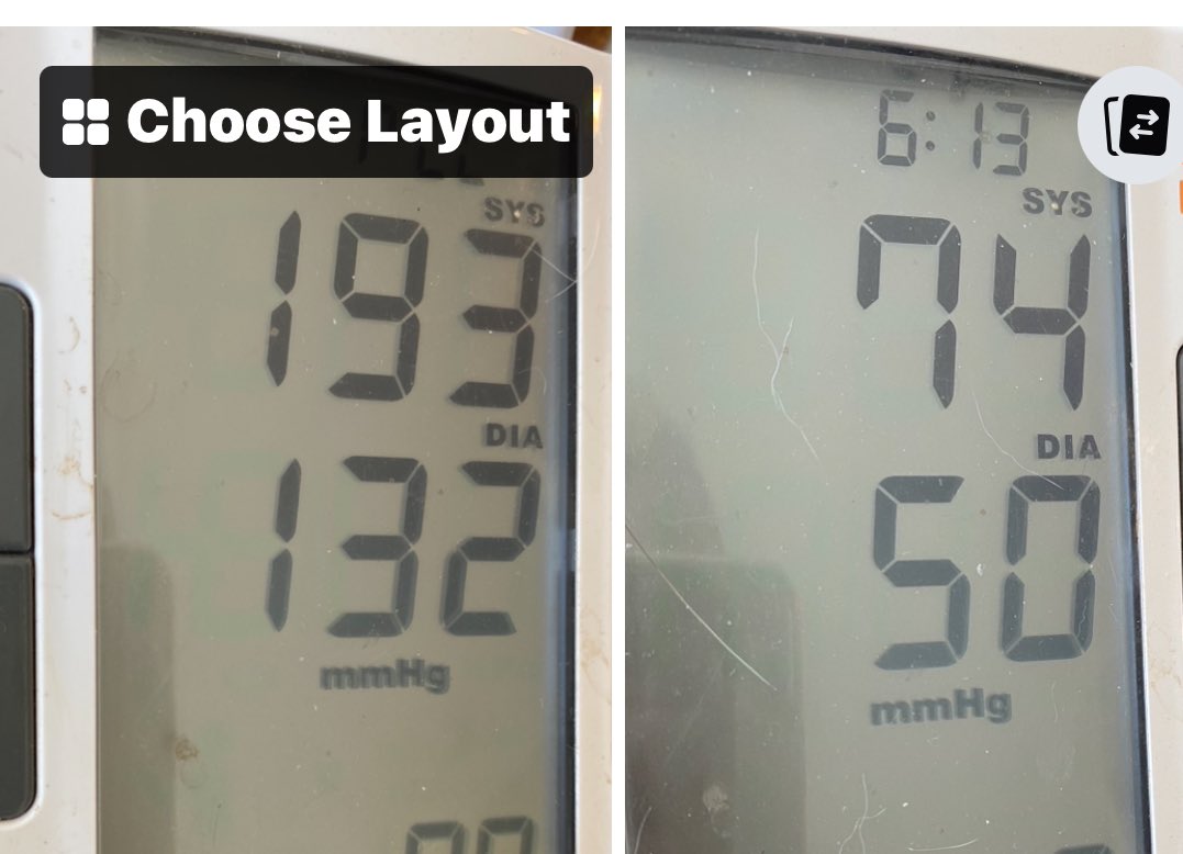mmcbridemd's tweet image. Life for an athletic runner after long covid. No vaccines (ie no contributing vaccine injury).
When histamine issues and dysautonomia make simply eating breakfast a dangerous undertaking.
Appreciate the acknowledgement of #LongCovid and the support of @HHSGov @NIHDirector_Jay