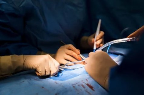 Could the Charlson-Age Comorbidity Index be useful in predicting surgical site infections? 🦠

Authors suggest there may be a sex-specific dose-response relationship when age is incorporated

➡️bit.ly/3G49Xur