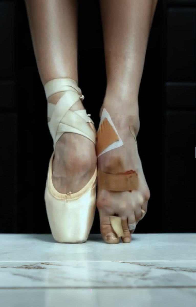 A ballerina friend of mine who injured her foot before a performance. 
She danced in this state. 
Ballet is the art that requires the most discipline beyond aesthetics.
Even if they are not injured, the feet of someone who has been doing ballet for a long time will look exactly