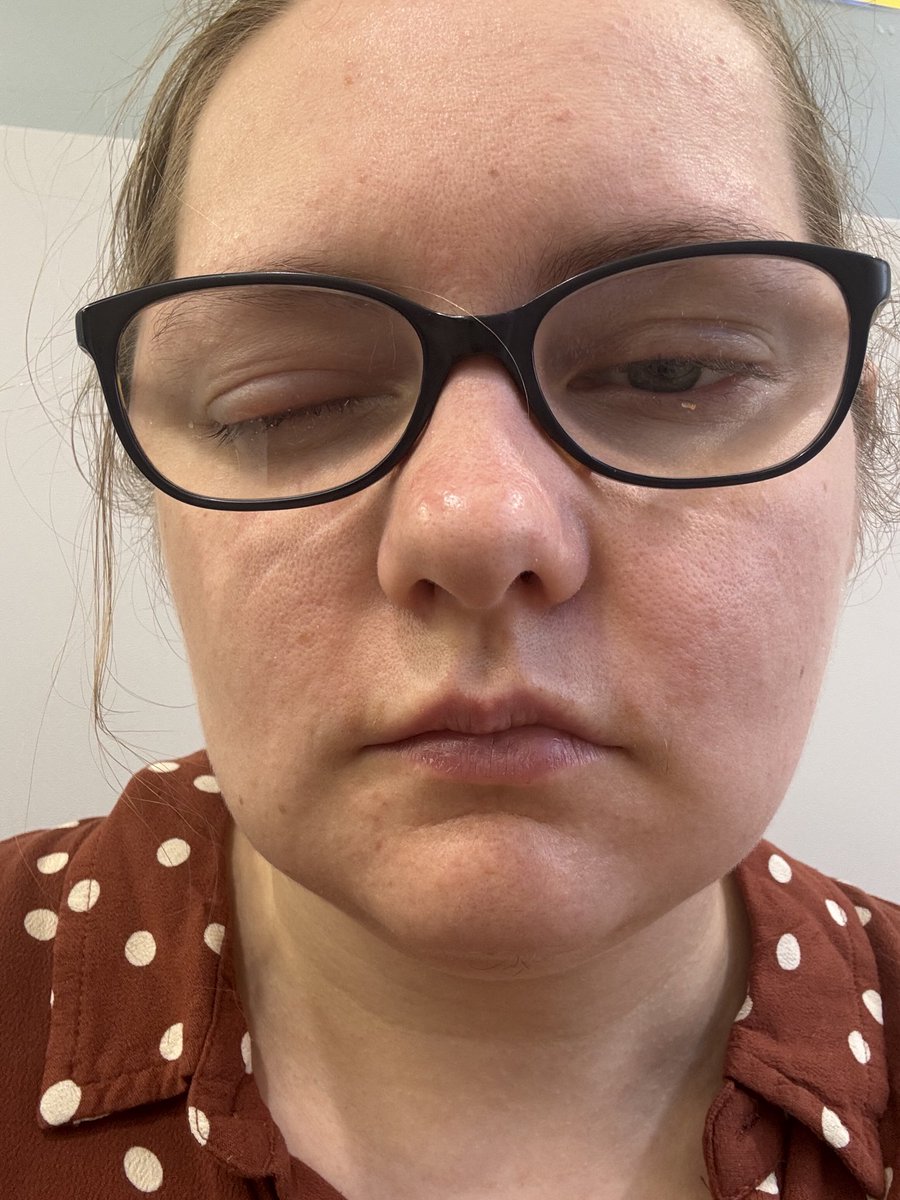 _lochness's tweet photo. Tell me why I woke up like this on Wednesday and was still trying to go to work 😂 two sick days and some eye drops later, all is better 😂 https://t.co/A2q9Exd8YN