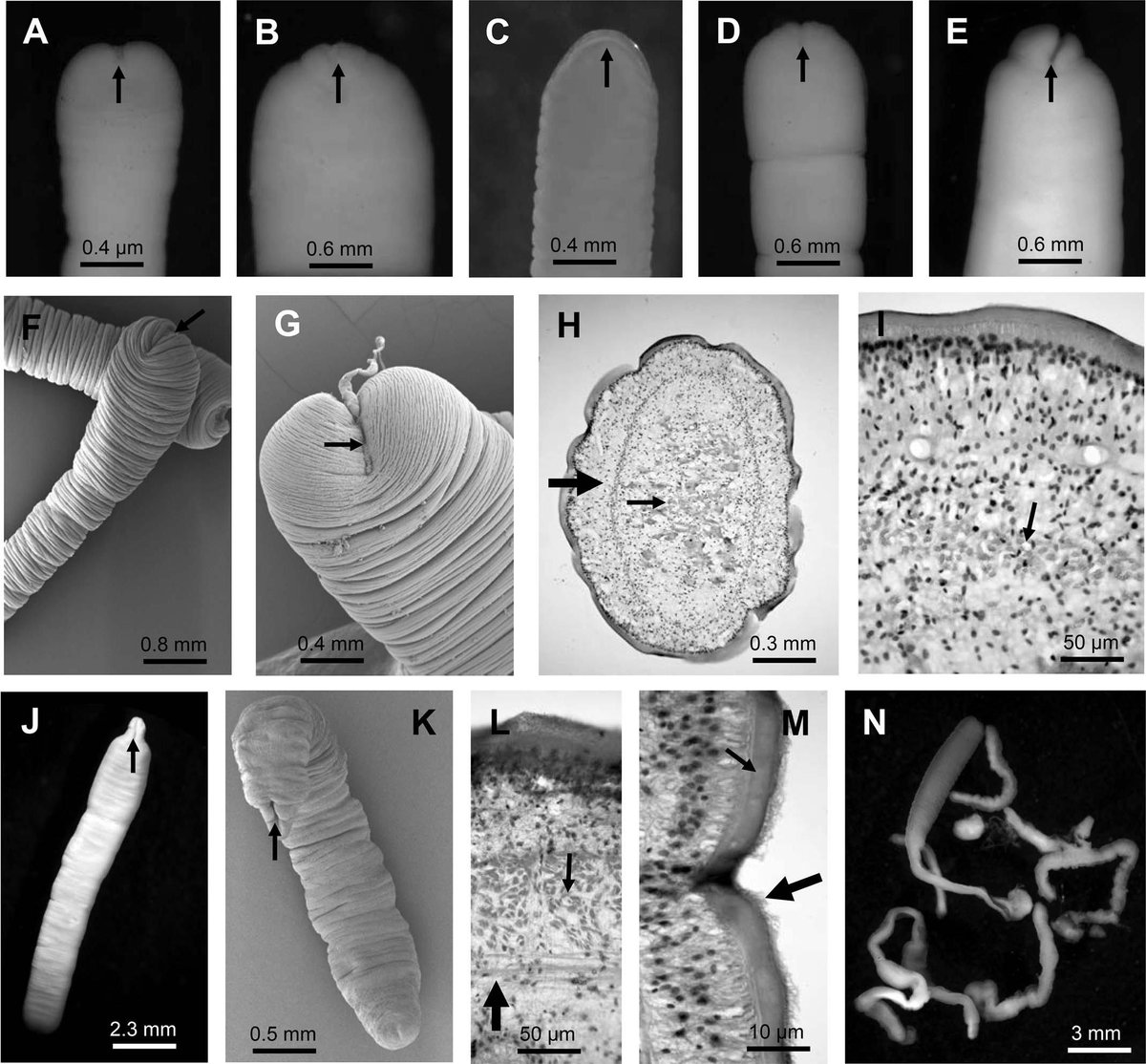 AmSocParasit's tweet image. New in the JP:
The Broad Fish Tapeworms Dibothriocephalus Spp., the Sealworm Phocanema cattani, & Other Endohelminth Parasites in the Returning Nonnative Chinook Salmon, Oncorhynchus tshawytscha, in the Valdivia River Basin, Chile.
By Torres, et al.
doi.org/10.1645/24-71