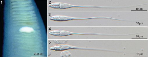 AmSocParasit's tweet image. New in the Journal of Parasitology:
Two New Species of Henneguya Infecting Gill of Blue Catfish from the Tallapoosa River and Chesapeake Bay Tributaries.
By Steven P. Ksepka, Heather Walsh, Christine L. Densmore, Triet N. Truong, & Stephen A. Bullard.
doi.org/10.1645/24-141
