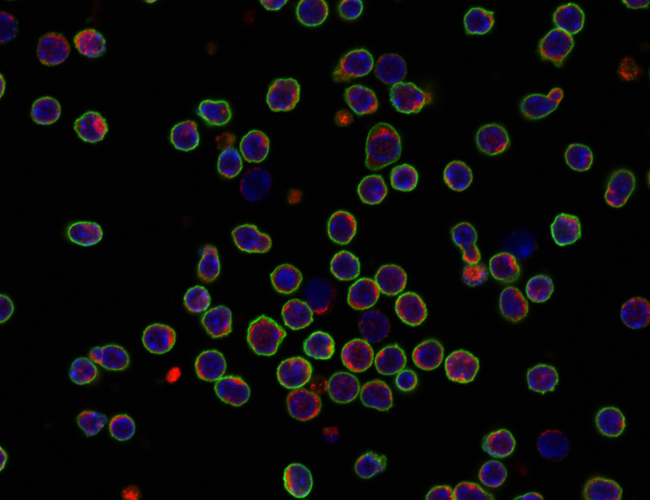 Science Immunology (@sciimmunology) on Twitter photo New research from <a href="/Feskelab/">Feske lab at NYU</a> suggests that chloride nucleotide-sensitive channel 1A (CLNS1A) is a key transcriptional and epigenetic regulator of pathogenic #CD4 #Tcells in mouse models of #autoimmune and inflammatory diseases. scim.ag/3HHrOYJ New research from <a href="/Feskelab/">Feske lab at NYU</a> suggests that chloride nucleotide-sensitive channel 1A (CLNS1A) is a key transcriptional and epigenetic regulator of pathogenic #CD4 #Tcells in mouse models of #autoimmune and inflammatory diseases. scim.ag/3HHrOYJ