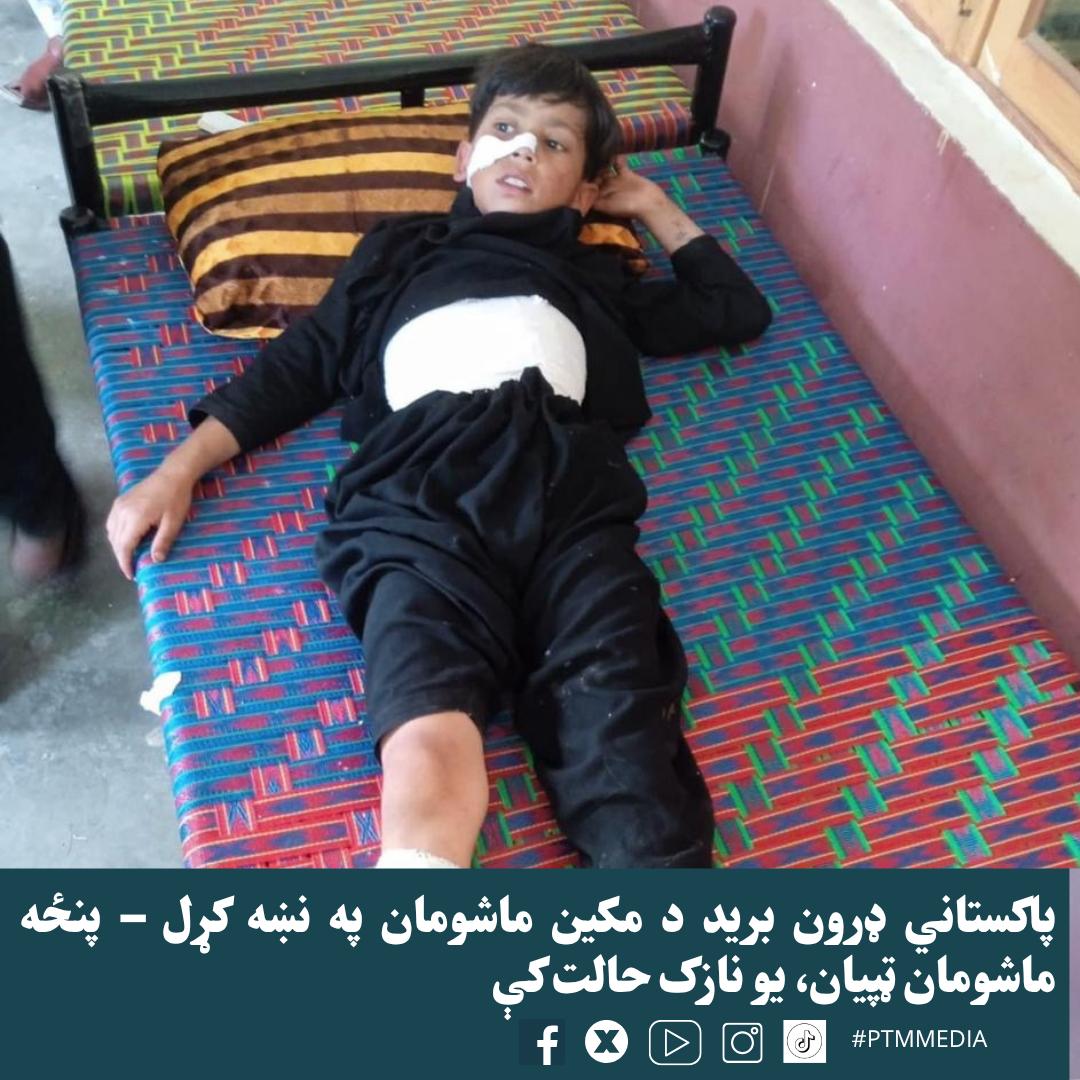 #PashtunRejectMilitarization
د پښتنو ماشومانو حال؛

 #PashtunsRejectDroneTerror
#PashtunRejectMilitarization
#PashtunRejectISPRDisinformation
#ISPRDisinformationExposed
#StopDeprivingPashtun