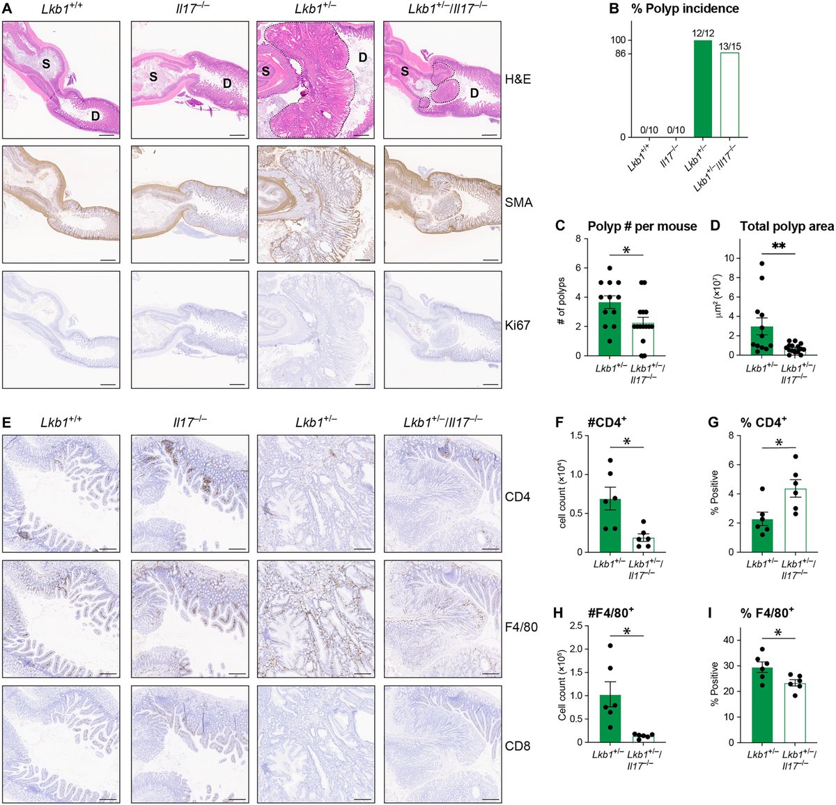 Waggoner Lab (@labwaggoner) on Twitter photo IL-17 is a therapeutic target for intestinal polyposis driven by mutations in the tumor suppressor LKB1
science.org/doi/10.1126/sc…
<a href="/ScienceAdvances/">Science Advances</a> <a href="/DrRGJonesLab/">Russell Jones</a> IL-17 is a therapeutic target for intestinal polyposis driven by mutations in the tumor suppressor LKB1
science.org/doi/10.1126/sc…
<a href="/ScienceAdvances/">Science Advances</a> <a href="/DrRGJonesLab/">Russell Jones</a>