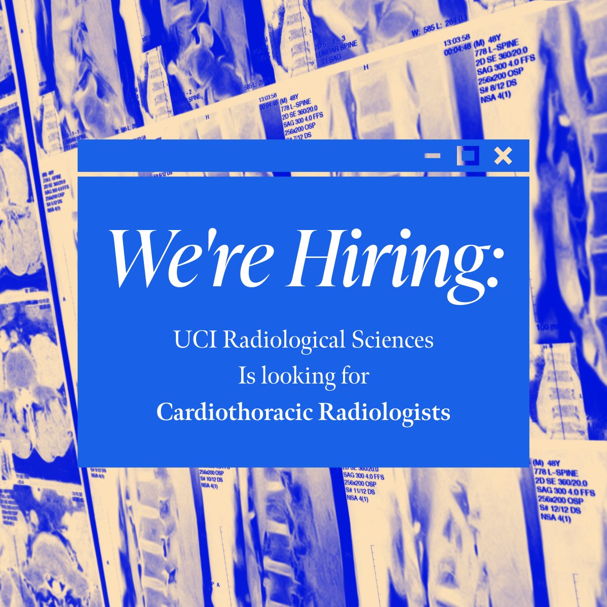#UCI Radiological Sciences is hiring for our Cardiothoracic #Radiology team! Know a qualified radiologist? Connect with us! Apply below! ow.ly/xAY950We9Y7 #Recruitment #OpenPosition #Opportunity.