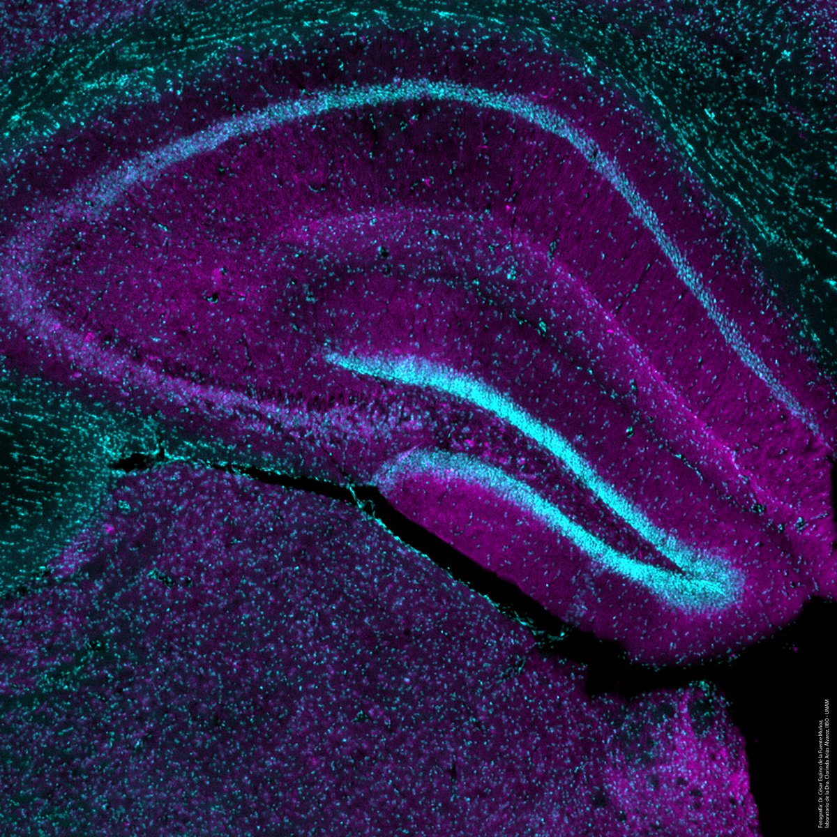 biomedicasunam's tweet image. 🔬El #IIBO felicita al Dr. César Espino de la Fuente Muñoz, posdoctorante del laboratorio de la Dra. Clorinda Arias, por obtener Mención Honorífica en el Concurso de fotografía científica UNAM 2025 en la Categoría Proyectos de Investigación. 📸: Hipocampo de ratón | #OrgulloIIBO