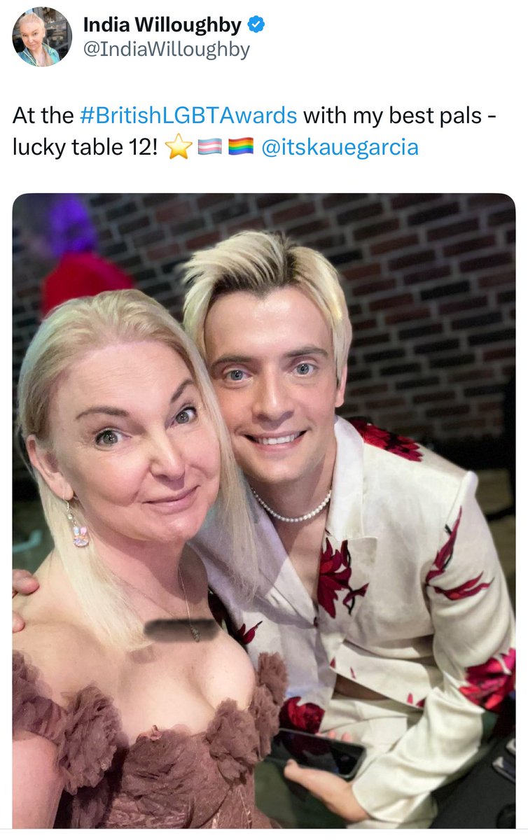 Interesting how bad he looks when he can’t filter. Whatever he’s wearing, it’s a fucking abomination