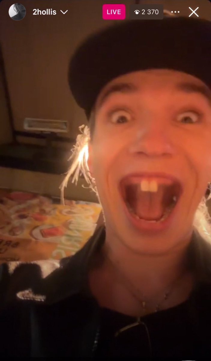 who do u fink gave u yer teef🥺