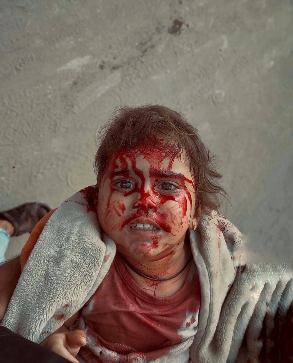 وثّقها المصوّر بعدسته… طفلة من غزّة، غارقة في دمائها، مذهولة مما أصابها، تنظر بدهشة لا تحتملها الذاكرة. وبعد لحظات، رحلت متأثرة بجراحها جراء قصف الاحتلال الإسرائيلي. لم يتبقَّ منها سوى صورة تهزّ القلب وتفضح الصمت. سلامٌ على روحكِ الصغيرة، يا زهرة قُطفت قبل أوانها. 💔