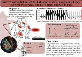 HeartRhythm (@hrs_journal) on Twitter photo Targeted epicardial pulsed field ablation of atrial ganglionated plexi: Electrophysiological and histological analysis in pigs
<a href="/Dominik_Linz/">Dominik Linz</a>
heartrhythmjournal.com/article/S1547-… Targeted epicardial pulsed field ablation of atrial ganglionated plexi: Electrophysiological and histological analysis in pigs
<a href="/Dominik_Linz/">Dominik Linz</a>
heartrhythmjournal.com/article/S1547-…