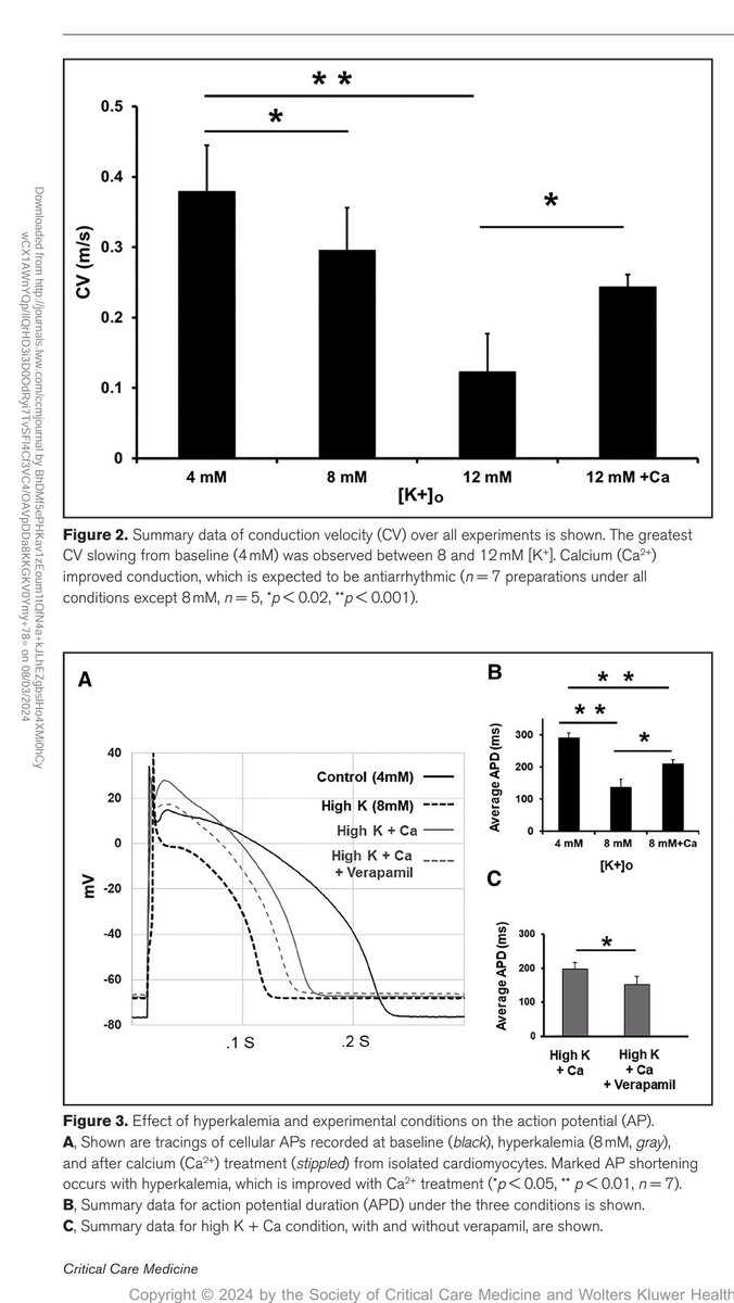 📢 ¡Rompiendo Mitos en Cardiología! 🫀 Un estudio reciente profundiza en el efecto del #Calcio en la #Hiperkalemia y sus implicaciones en la conducción cardíaca. 🧐👇
🩺Tradicionalmente, se creía que el calcio "estabilizaba la membrana" en la hiperkalemia al restaurar el