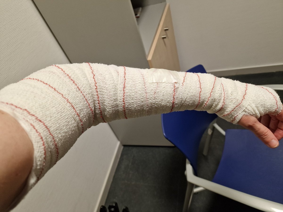 Jali #STOPokupas (@jaliroller) on Twitter photo Noche de viernes diferente, visita a urgencias, afortunadamente sin fractura. Cuidado con los vehículos que se saltan los semáforos, a mí me han arrollado y puedo contarlo, pero otros no Noche de viernes diferente, visita a urgencias, afortunadamente sin fractura. Cuidado con los vehículos que se saltan los semáforos, a mí me han arrollado y puedo contarlo, pero otros no