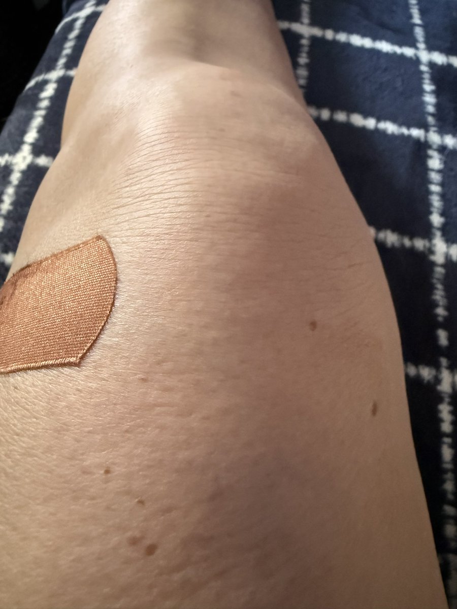 Good afternoon from my end of the world. My knee is still swollen so I called my orthopedic (surgeon) doctor and I told her because I’m concerned the swelling didn’t barely go down and she said that she did not drain all of the fluid out of my knee. I was like WTAF why? She said
