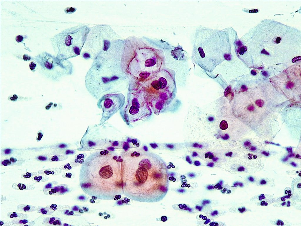 Roxana Chávez Cito, MIAC. tweet media