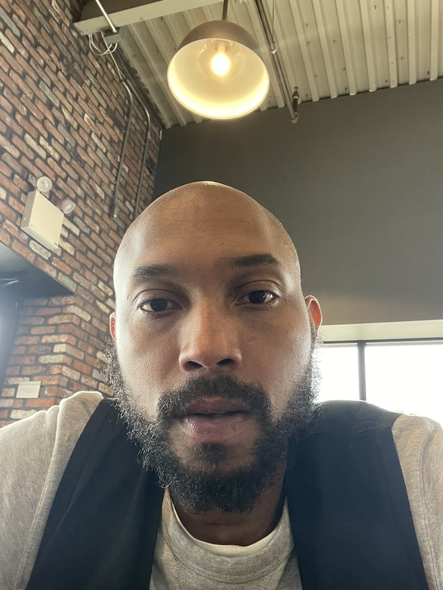 Making bald look cool af unfortunately