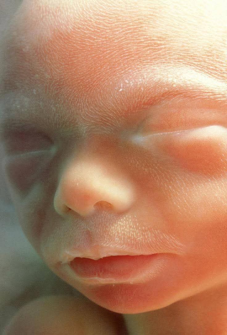 👶✨ La delicadeza de la vida antes de nacer

Lo que estás viendo no es un rostro cualquiera…
Es el primer plano de un feto humano en desarrollo intrauterino. Una mirada íntima al milagro de la vida capturado con una nitidez extraordinaria.

🔍 En esta imagen se puede observar