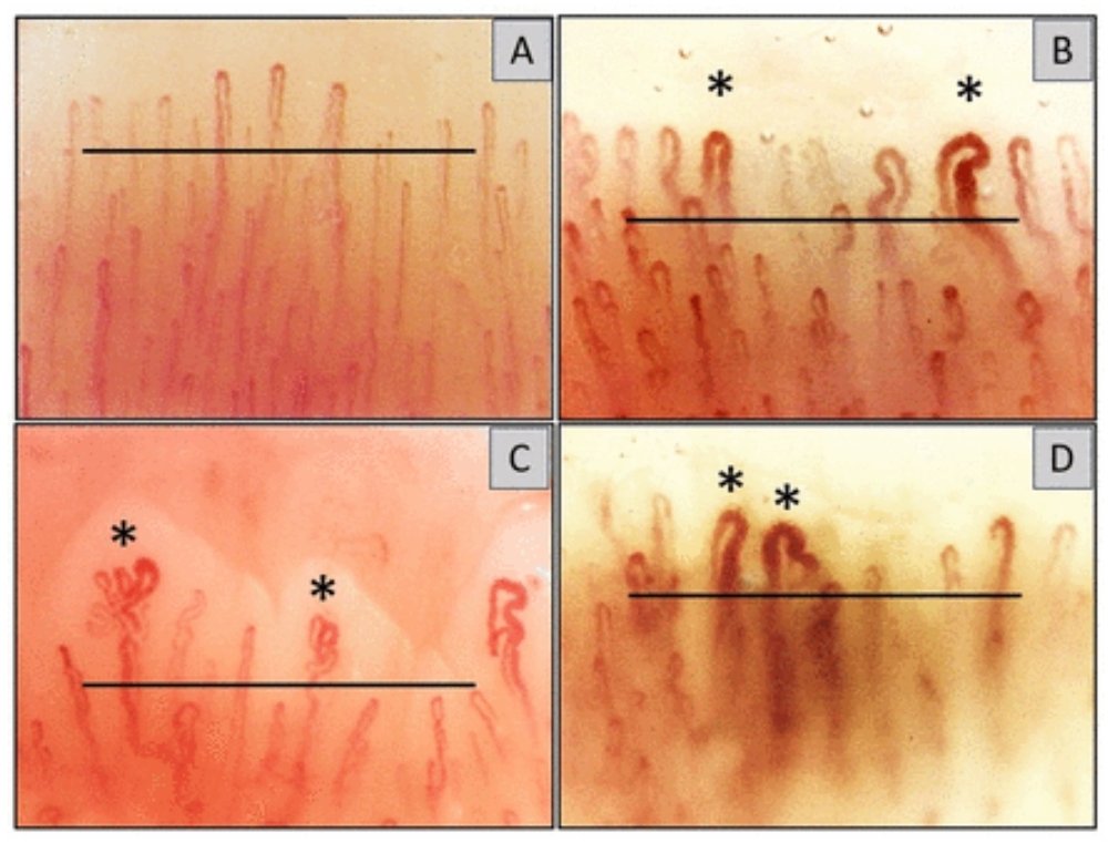 ChandraDKMiller's tweet photo. This image right here is *the* image of the pandemic.

Of all the scans, visualizations, graphs, etc, detailing the damage being done, this is the image I keep coming back to.

Specifically, letter B.

1/4 https://t.co/y7fkgTaziB