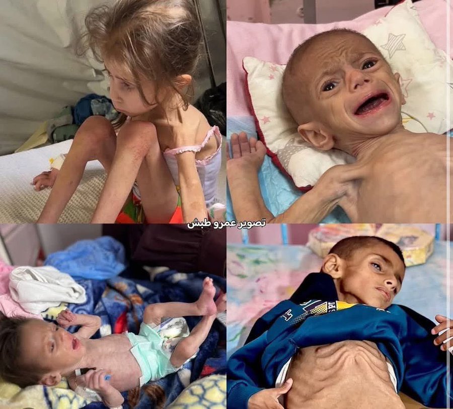 What is the fault of these children?
If you see this pic, reply with 🇵🇸 spread it💔