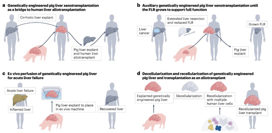 Burcin Ekser, MD, PhD (@burcinekser) on Twitter photo Hot off the press. Promise and pitfalls of liver #xenotransplantation.
Good things will happen…
<a href="/LoyolaChicago/">Loyola University Chicago</a> <a href="/loyolasurg_dept/">Loyola's Department of Surgery</a> <a href="/LoyolaStritch/">Stritch School of Medicine Loyola Chicago</a> <a href="/ASTSChimera/">ASTS</a> <a href="/AASLDtweets/">AASLD</a> <a href="/_ILTS_/">ILTS</a> <a href="/NatRevGastroHep/">Nature Reviews Gastroenterology & Hepatology</a> Hot off the press. Promise and pitfalls of liver #xenotransplantation.
Good things will happen…
<a href="/LoyolaChicago/">Loyola University Chicago</a> <a href="/loyolasurg_dept/">Loyola's Department of Surgery</a> <a href="/LoyolaStritch/">Stritch School of Medicine Loyola Chicago</a> <a href="/ASTSChimera/">ASTS</a> <a href="/AASLDtweets/">AASLD</a> <a href="/_ILTS_/">ILTS</a> <a href="/NatRevGastroHep/">Nature Reviews Gastroenterology & Hepatology</a>
