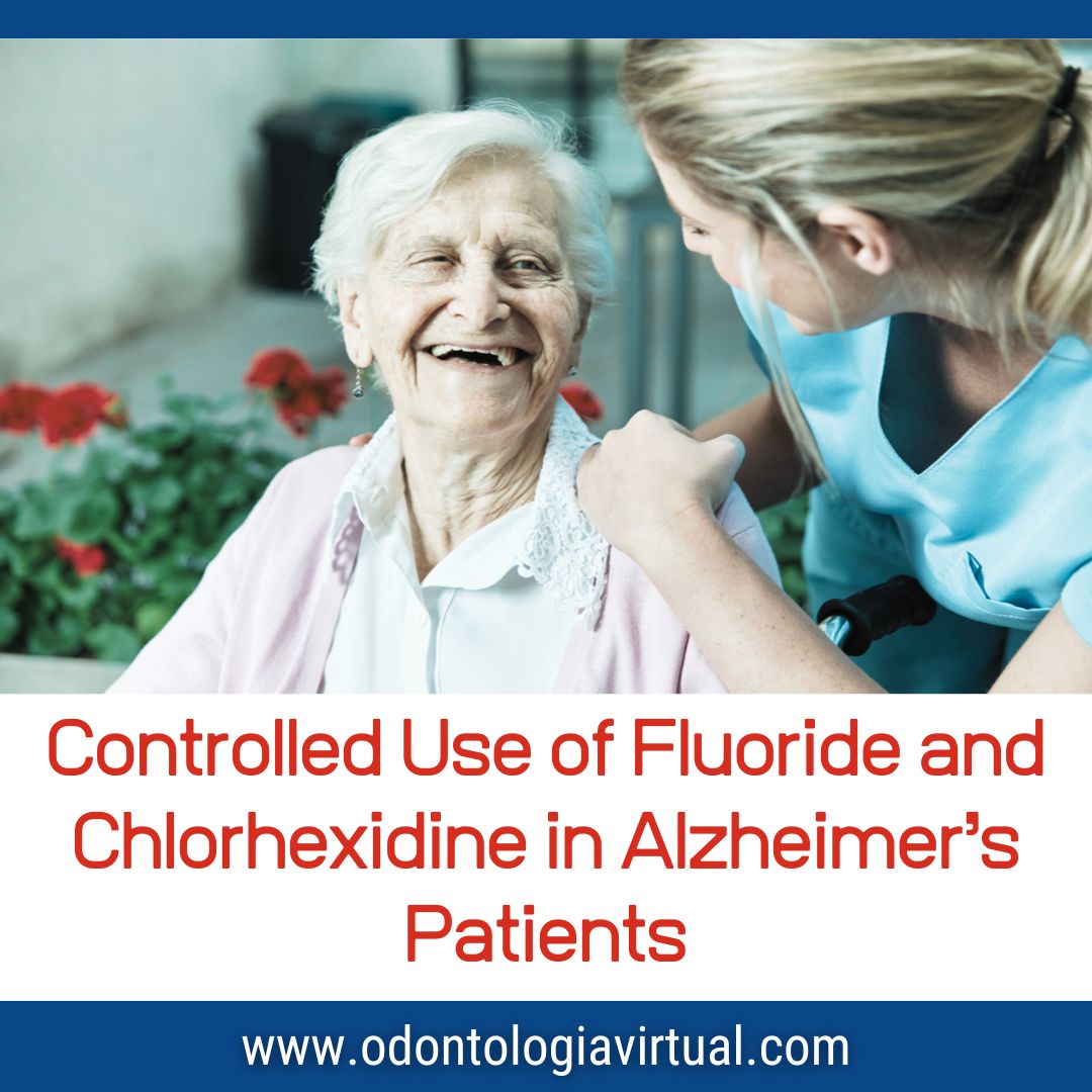 LINK odontologiavirtual.com/2025/06/contro… 

Patients with Alzheimer’s disease experience progressive cognitive and motor decline, which significantly impairs their ability to maintain proper oral hygiene.

As a result, they are at a higher risk of dental caries, periodontal disease, and