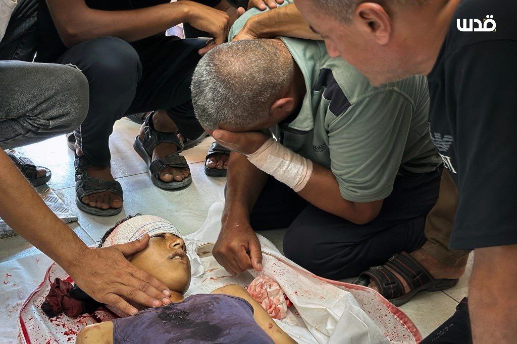 🔴 Khan Younis | Nasser Hospital

🔴Who will stop this sadness in Gaza?

🔴Grief engulfed Nasser Hospital as families buried their loved ones killed by israeli war criminals while trying to collect aid in Rafah.

🔴They stood in line for flour.
They came home in body bags.
The