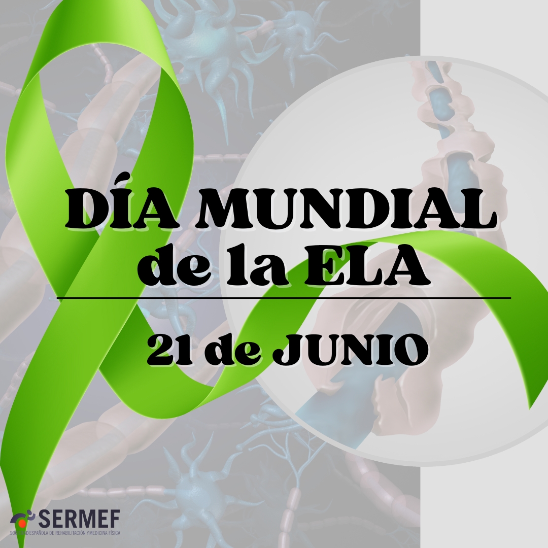 🧠En el #DíaMundialdelaELA, desde SERMEF destacamos el papel esencial de la rehabilitación foniátrica y logopédica en personas con #ELA.

Preservar la comunicación y la deglución mejora su calidad de vida y previene complicaciones.