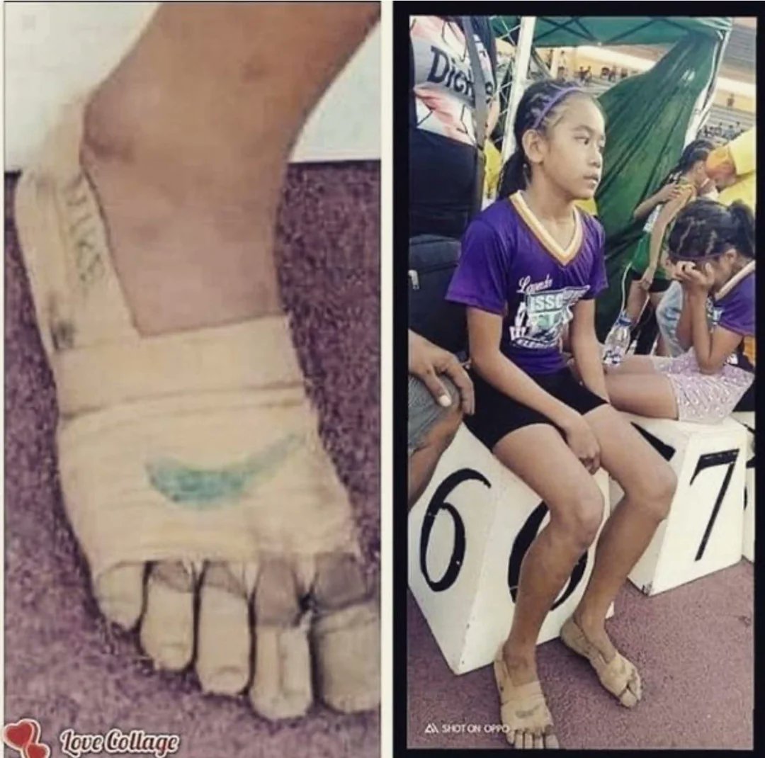 У 11-летней девочки нет денег на обувь, она бинтует ноги и выигрывает 3 золотые медали

Если Nike не станет ее спонсором, они понесут большие убытки.

Импровизированная "обувь" была сделана из бинтов и ткани, с ручным логотипом Nike