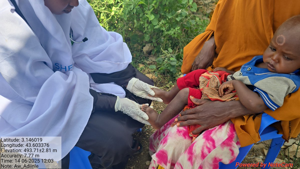 SARD199's tweet image. With SHF donor support, SARD is delivering life-saving OTP nutrition to children in crisis.
Every treatment brings a child back from the brink of malnutrition.
This is impact. This is hope.
#SHF
#SARD
#NutritionResponse