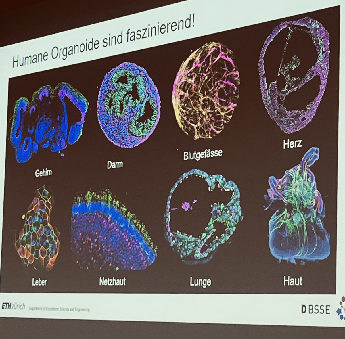 Swiss3RCC's tweet image. 🧬 Wie entwickelt sich das menschliche Gehirn – ganz ohne Tierversuche? Barbara Treutlein (@ETH ) erforscht mit Organoiden die menschliche Hirnentwicklung im Labor. #3Rs #Organoide #ETHZürich #Swiss3RCC #Alternativmethoden