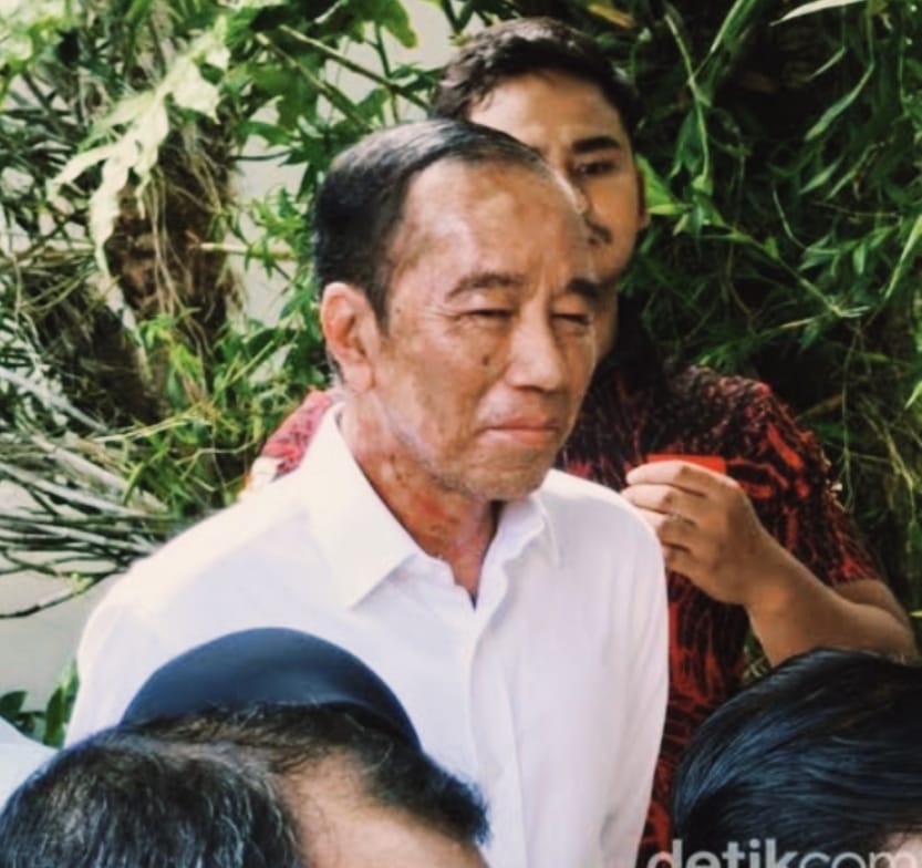 Jokowi 21 Juni 2025

Sepertinya masih sakit.
Sekali lagi saya ingatkan, Pak Jokowi, anda sakit serius, tidak bisa dibiarkan tanpa perawatan terbaik.

Ada luka memanjang di leher. Pasti gatal sekali rasanya sekujur tubuh.

Semoga lekas sembuh, Pak. 
Segera ke Rumah Sakit, jangan