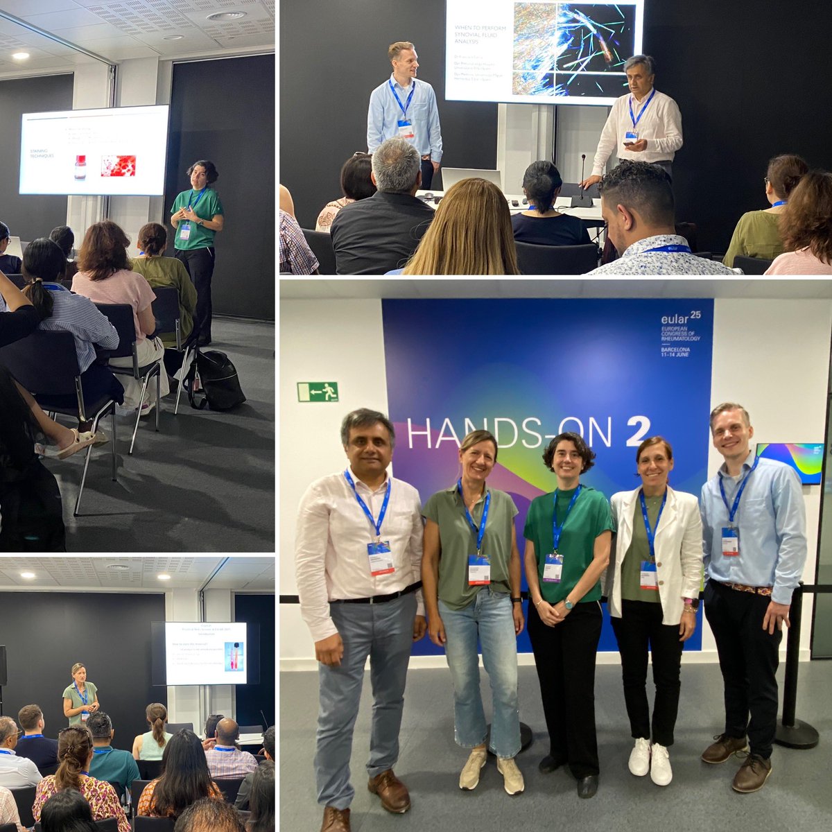 The Hands-on Course on Crystal Identification – Synovial Fluid Analysis at the European Congress of Rheumatology #EULAR2025 has sold out! With Abhishek Abhishek, Francisca Sivera, Anne-Kathrin Tausche, Francesca Oliviero, and Thomas Shneidereit. 
#synovialfluid
#rheumatology