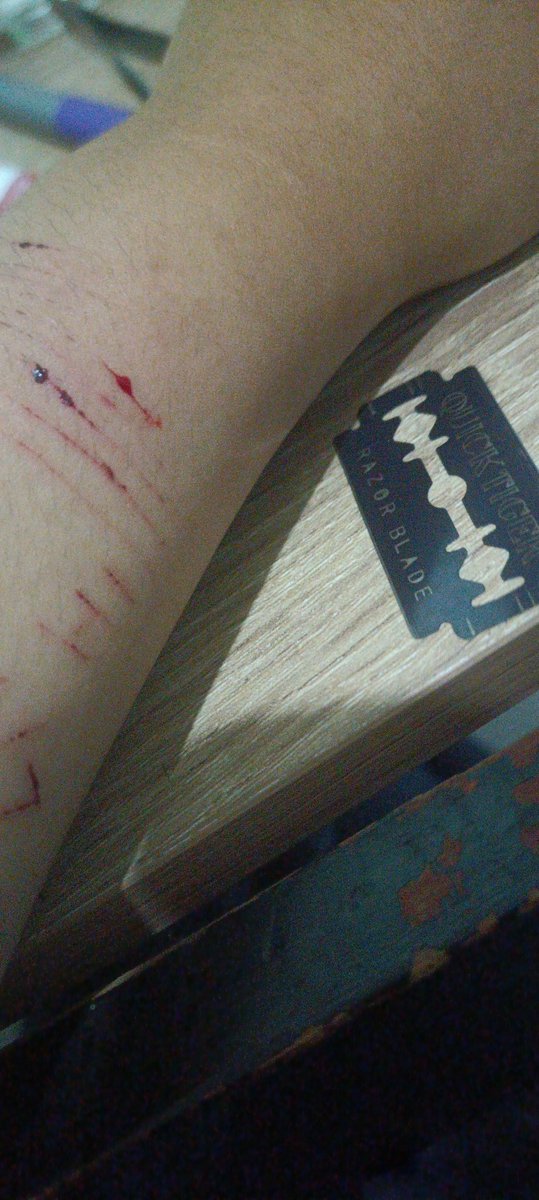 bli20phile's tweet photo. how yummy u are babe~
.
.
.
#shedtwt #shtwt #edtwt #SH #selfharm #kys #kms #die #Bleeding #Hate #RAZOR #Blade #lovedie #LifeToDie #newblade #blood #moots https://t.co/38O7fXE6ur