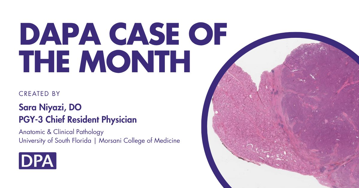 dpatweet's tweet image. A 42-year-old female presents with a palpable thyroid nodule. Ultrasound reveals a 1.4 cm solid, hypoechoic mass with irregular margins. What is the significance?
Contributed by: Sara Niyazi
Take the assessment: zurl.co/Gery0