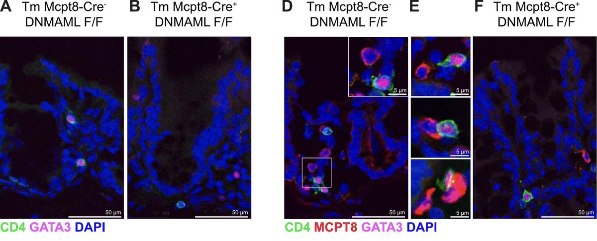 MucosalImmunol's tweet image. Notch-activated basophils support intestinal CD4+ T cell fate and function during Trichuris muris infection
mucosalimmunology.org/article/S1933-…