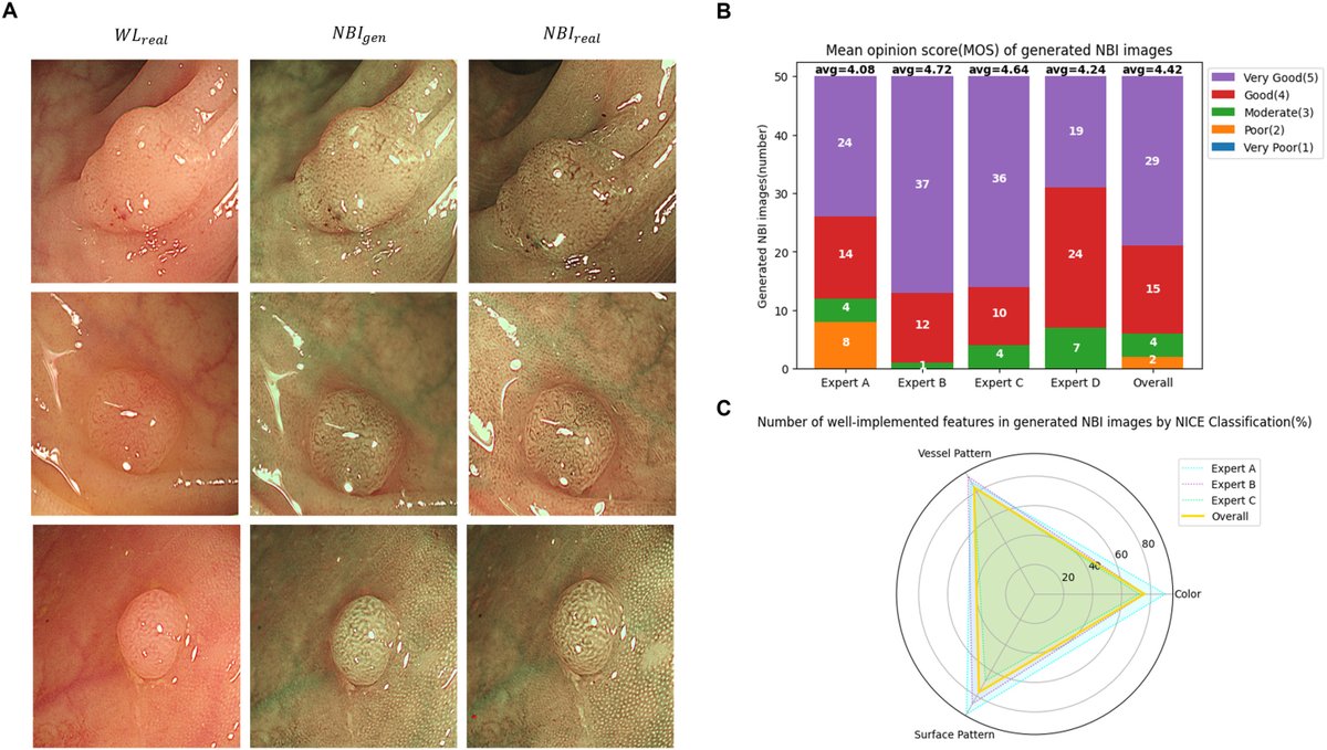 TIGE (@aga_tige) on Twitter photo π¨ New Article π¨
π© White Light Imaging to Narrow Band Imaging via Style Transfer: A Feasibility Test for Enhancing Colonoscopic Diagnostic
π ow.ly/VIxr50W1RYe π¨ New Article π¨
π© White Light Imaging to Narrow Band Imaging via Style Transfer: A Feasibility Test for Enhancing Colonoscopic Diagnostic
π ow.ly/VIxr50W1RYe