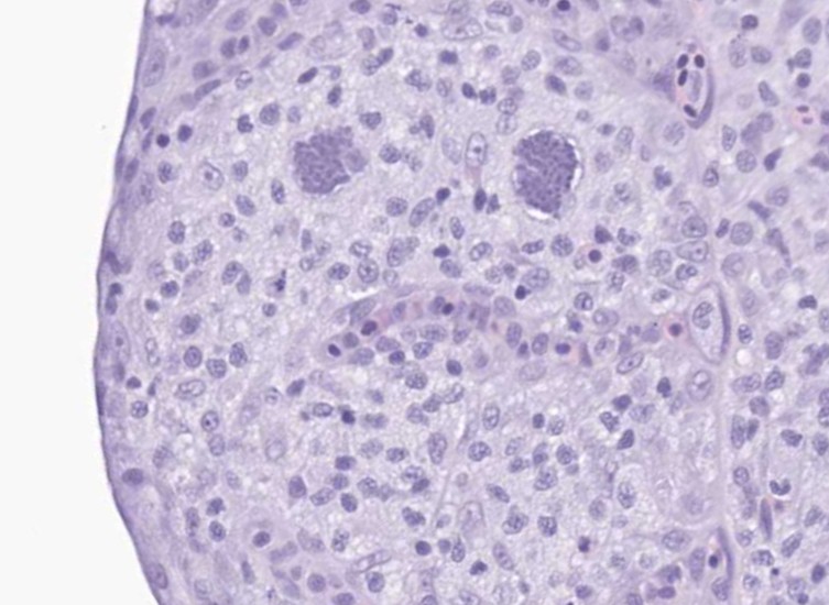 Ok, Team #VetPath, it's Monday, let's go! 

What's the deal with these autopsy findings in a channel catfish?

❓Histopath features
❓Condition
❓Cause